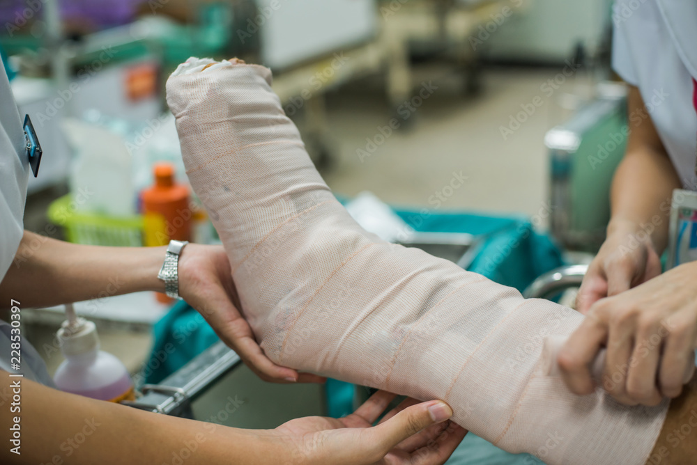 Splinter Injury Leg Patient with broken leg and splinted for treatment in the hospital ...