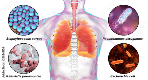 Human respiratory pathogens, bacteria that cause nosocomial pneumonia, 3D illustration. Staphylococcus aureus, Pseudomonas aeruginosa, Klebsiella pneumoniae and Escherichia coli photo