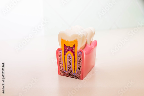 tooth model without caries, tooth decay in dentist's office. Healthy teeth concept . children's dentist. Copy space
