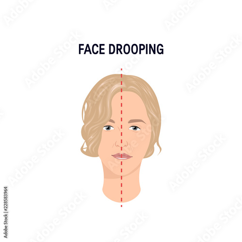 Face drooping concept