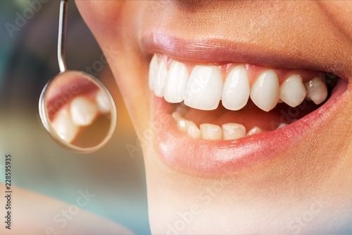 Odontology periodontal attractive teenager beautiful girl photo