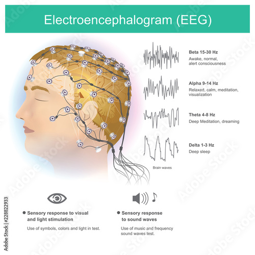 Electroencephalogram (EEG).
The use of electrodes to read small electromagnetic waves from the human brain. photo