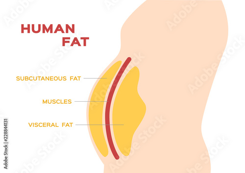 human belly and abdomen fat layer vector / subcutaneous and visceral fat photo