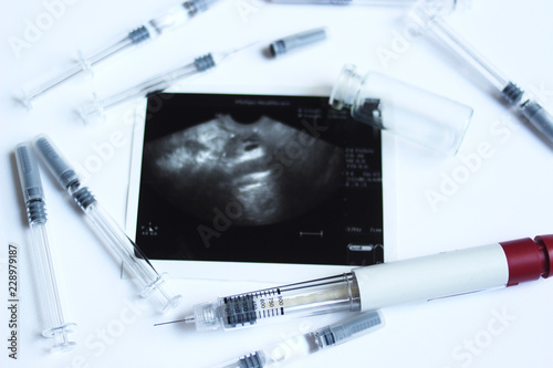 Assisted reproductive technology injection pen and small syringes with ovarian ultrasound in the middle. IVF and IUI Treatment Drugs. Medication  for infertility treatment