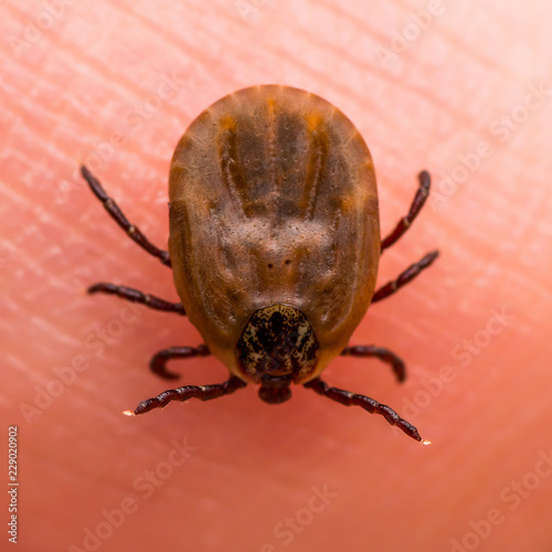 Encephalitis Virus or Lyme Borreliosis Disease Infectious Dermacentor Tick Arachnid Insect on Skin Macro