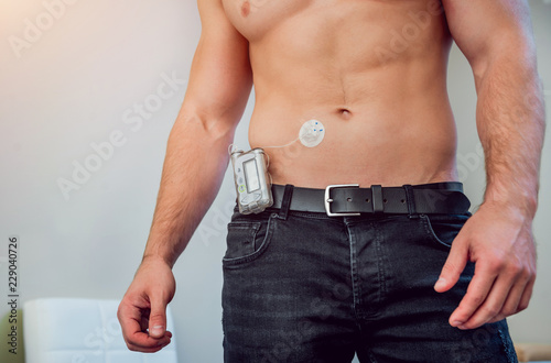 Diabetic man with an insulin pump connected in his abdomen and keeping the insulin pump on his belt.
