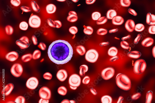 Εκτύπωση καμβά Iron deficiency anemia, 3D illustration showing small hypochromic red blood cells, anisocytosis