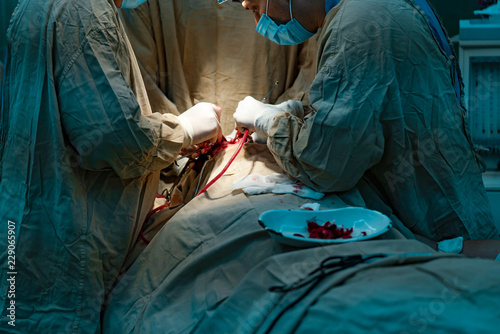 surgeons stand over the face of a man and perform an operation in a hospital. A plate with a bloodied bandages lay on the patient during surgery. Close up