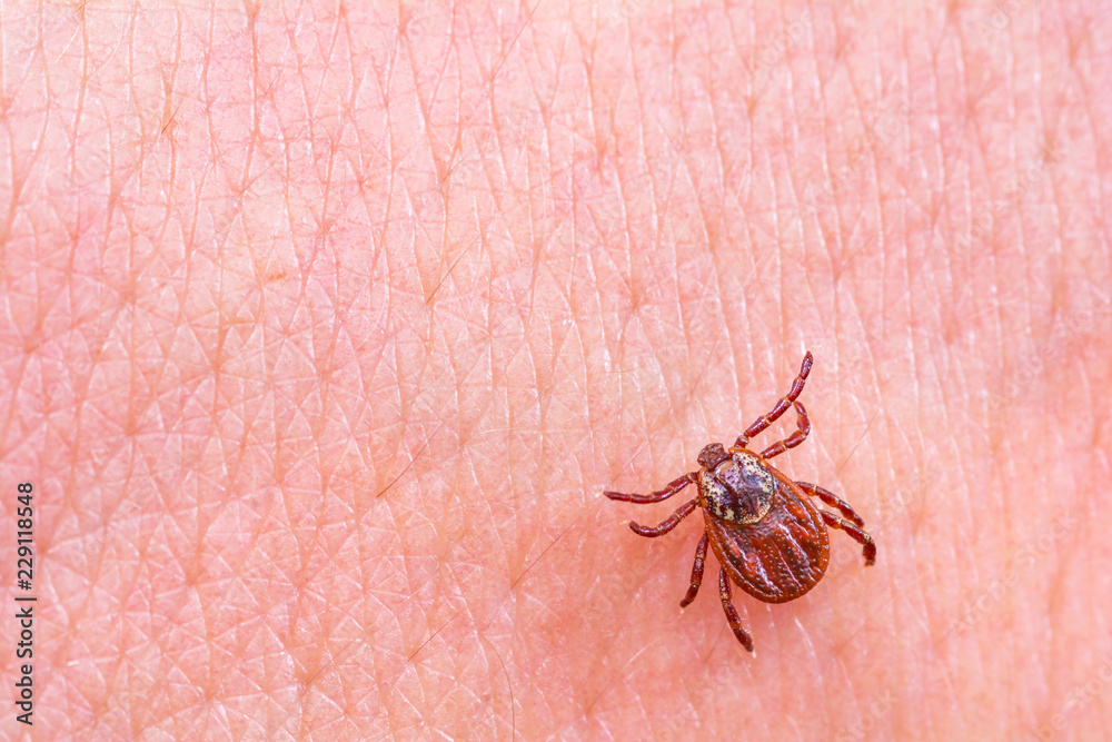 Mite on the skin. Danger of tick bite.