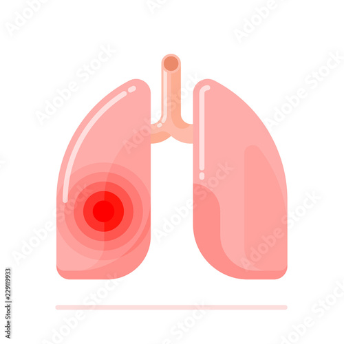 Flat design illustration of human lungs disease