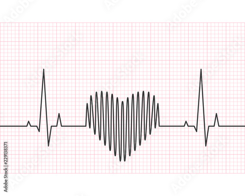 Heart rate line with grid in the background. Heartbeat, pulse and rythm, electrocardiogram and ECG concept. Vector illustration.