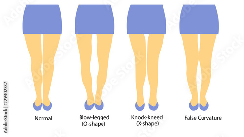 Vector illustration with different shapes of women legs