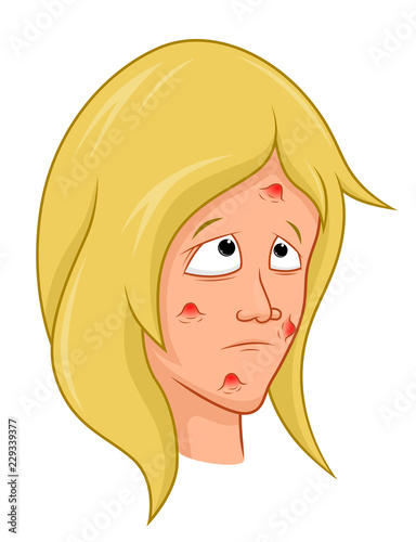 Cartoon girl with acne