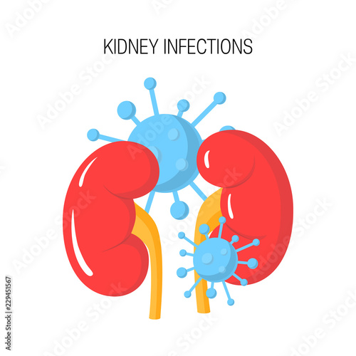 Kidney infection vector concept