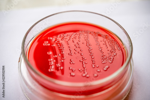 Streptococci on Agar