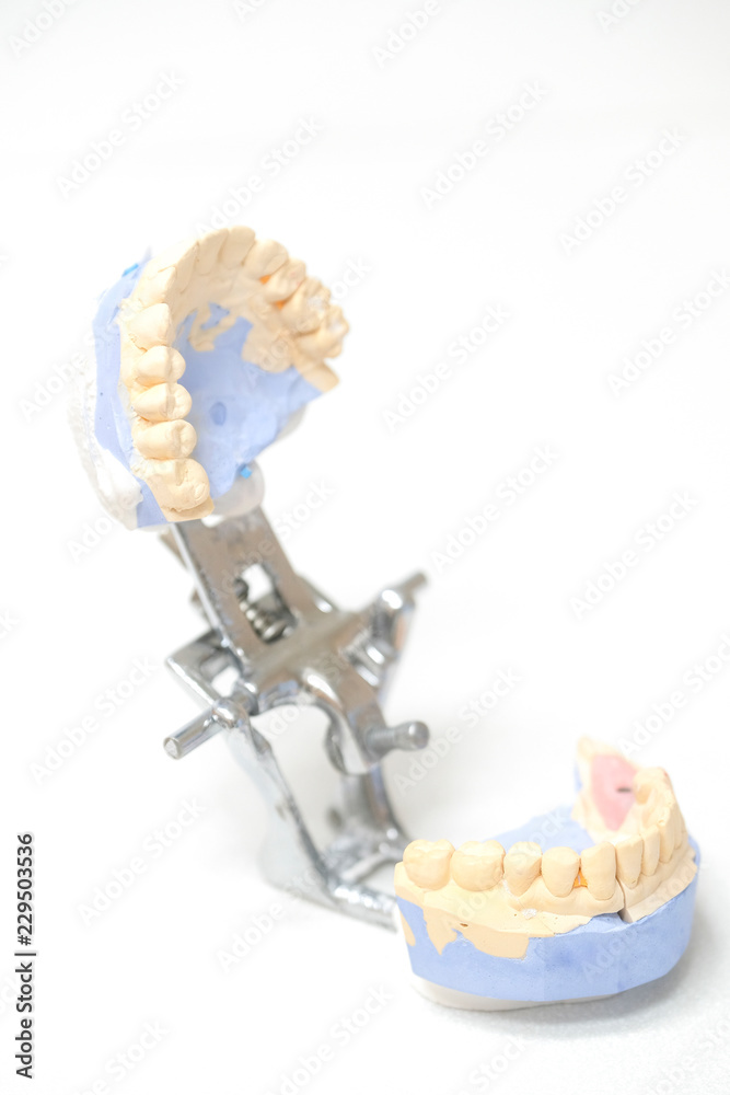 set of the false teeth set of the false teeth
