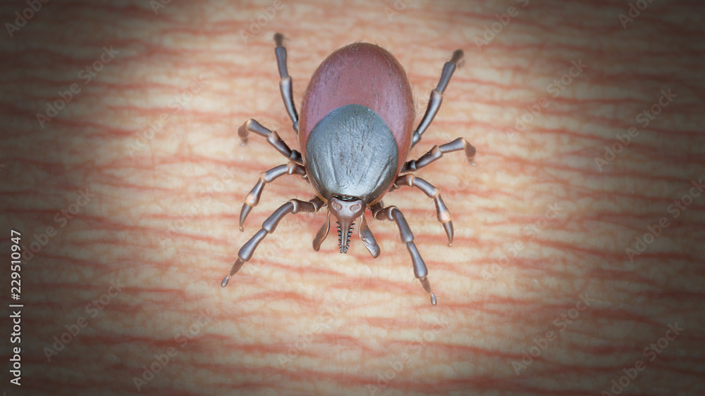 3d rendered illustration of a tick biting a human