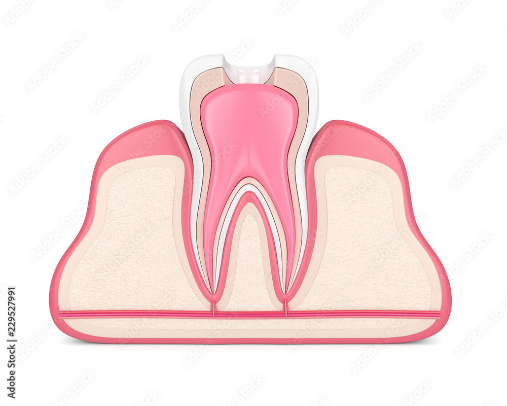 3d render of tooth with root canal treatment procedure 3d render of tooth with root canal treatment procedure