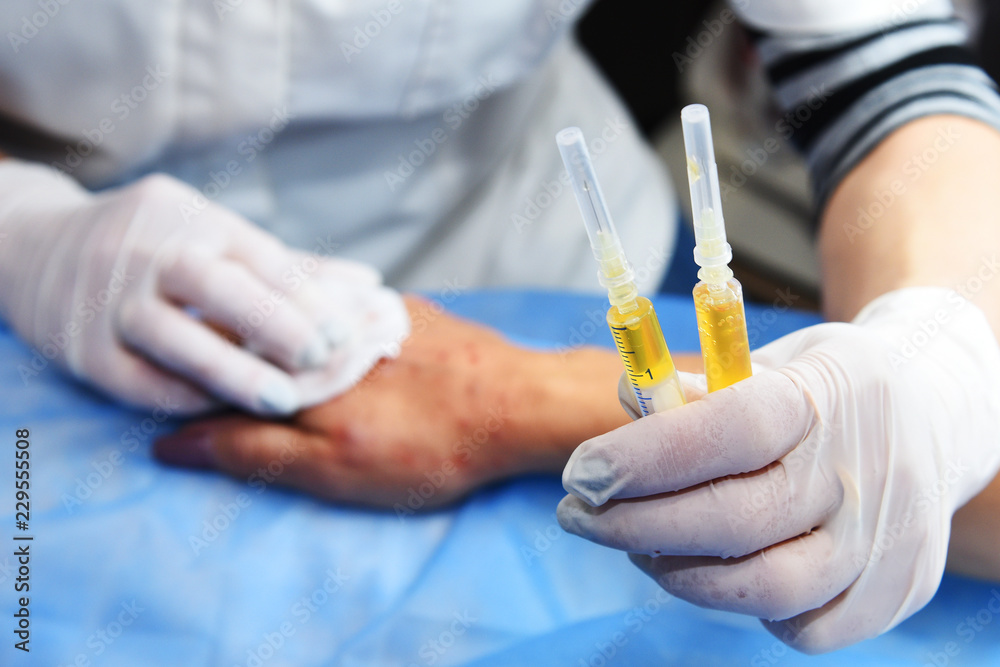 Plasmolifting hands. Injections for rejuvenation and skin regurgitation from human plasma. A modern beauty treatment. Plasmolifting hands. Injections for rejuvenation and skin regurgitation from human plasma. A modern beauty treatment.