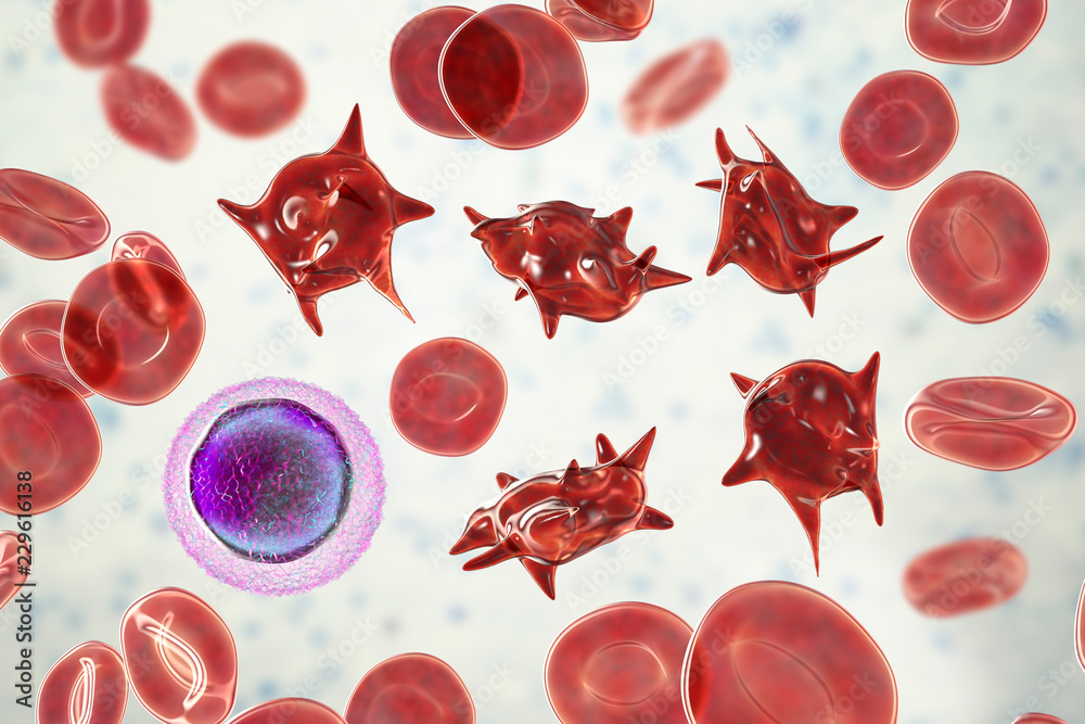 Acanthocytes, abnormal red blood cells with thorn-like projections, 3D ...