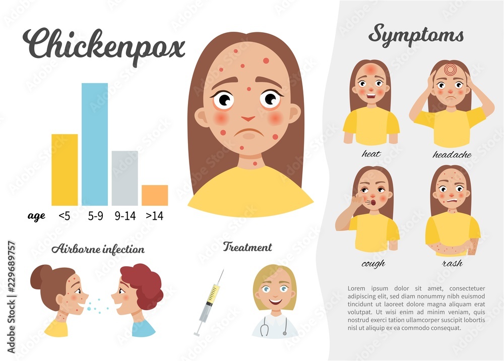 Infographics of chickenpox. Statistics, symptoms, treatment. Pretty cartoon  girl. Stock Vector | Adobe Stock