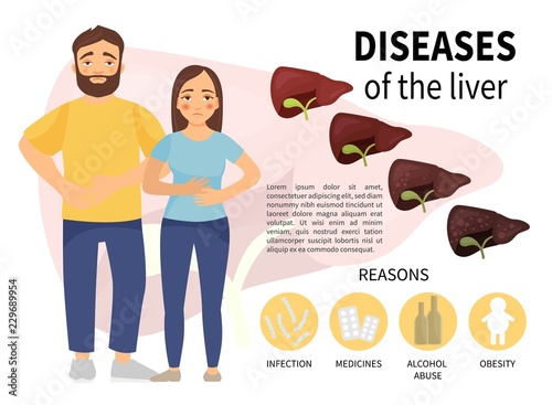 Infographics of liver disease. A cartoon girl and a man. Stages of liver destruction. Causes of the disease.