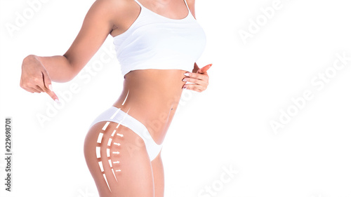 Female body with the drawing arrows on it. Fat lose, liposuction and cellulite removal concept