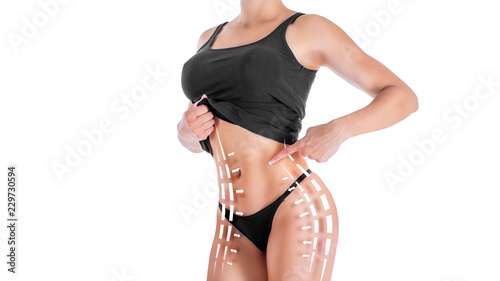 Female body with the drawing arrows on it isolated on white. Fat lose, liposuction and cellulite removal concept