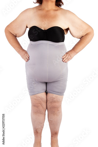 Middle aged women with saggy skin after extreme weight loss photo