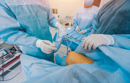 Canvas Print Arthroscope surgery