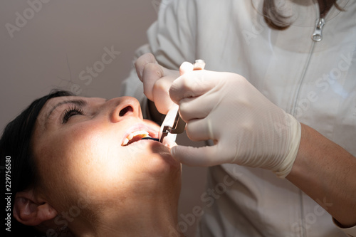 Woman in 40s smiling while dentist in white latex gloves check condition of her teeth