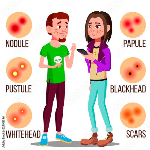 Upset Teenager With Pimples On The Face Vector. Isolated Illustration