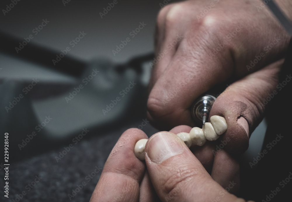 A dental technician makes a prosthetic teeth. laboratory. close-up. A dental technician makes a prosthetic teeth. laboratory. close-up.