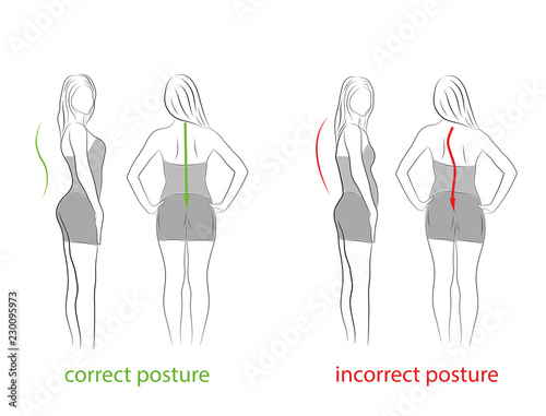 correct and incorrect posture. side and rear view. medical recommendations. vector illustration.