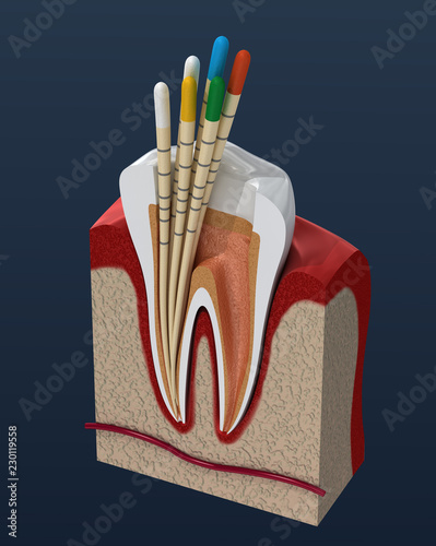 Gutta percha endodontics instrument, dental anatomy. 3D illustration photo