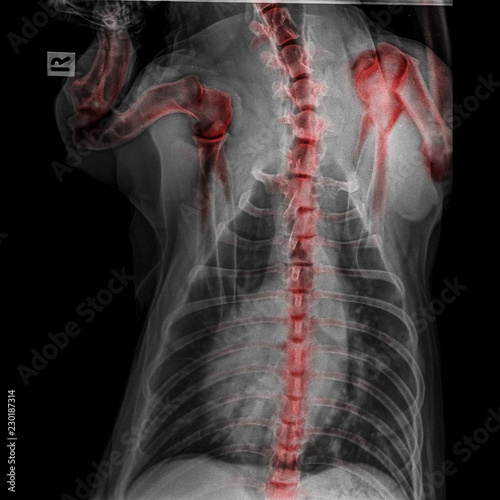 X-ray of dog posterior view closed up thorax and chest red highlight foreleg bone in shoulder joint and neck bone to back bone-degenerative joint disease in dog- Veterinary medicine-Veterinary anatomy