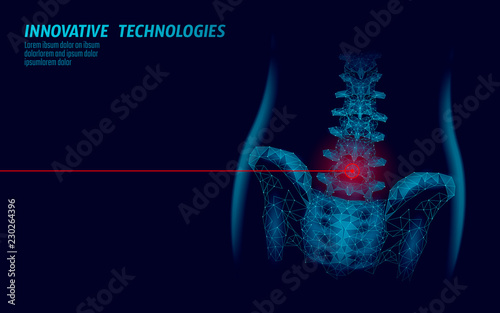 Human spine hip lumbar radiculitis pain low poly. Geometric polygonal particle triangle point line future medicine technology blue red painful area vector illustration