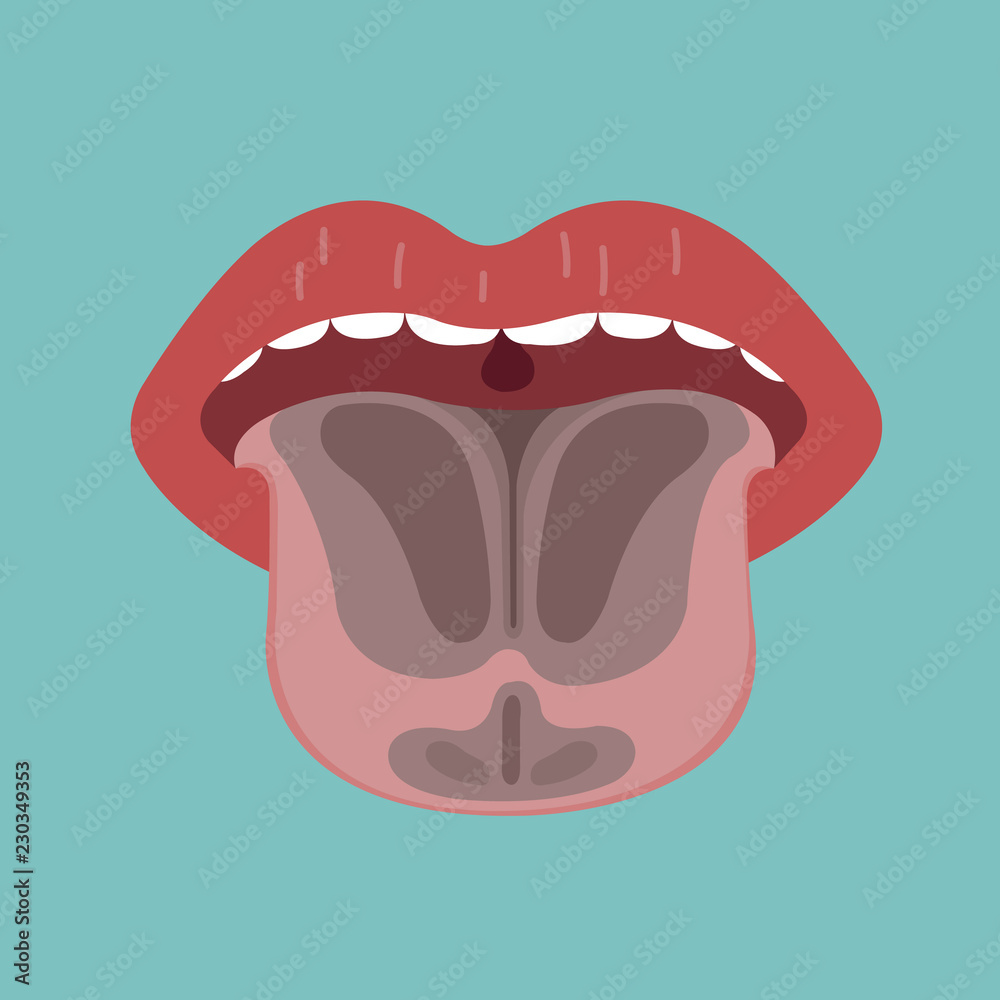 Tongue disease, vector of organ concept. Tongue disease, vector of organ concept.