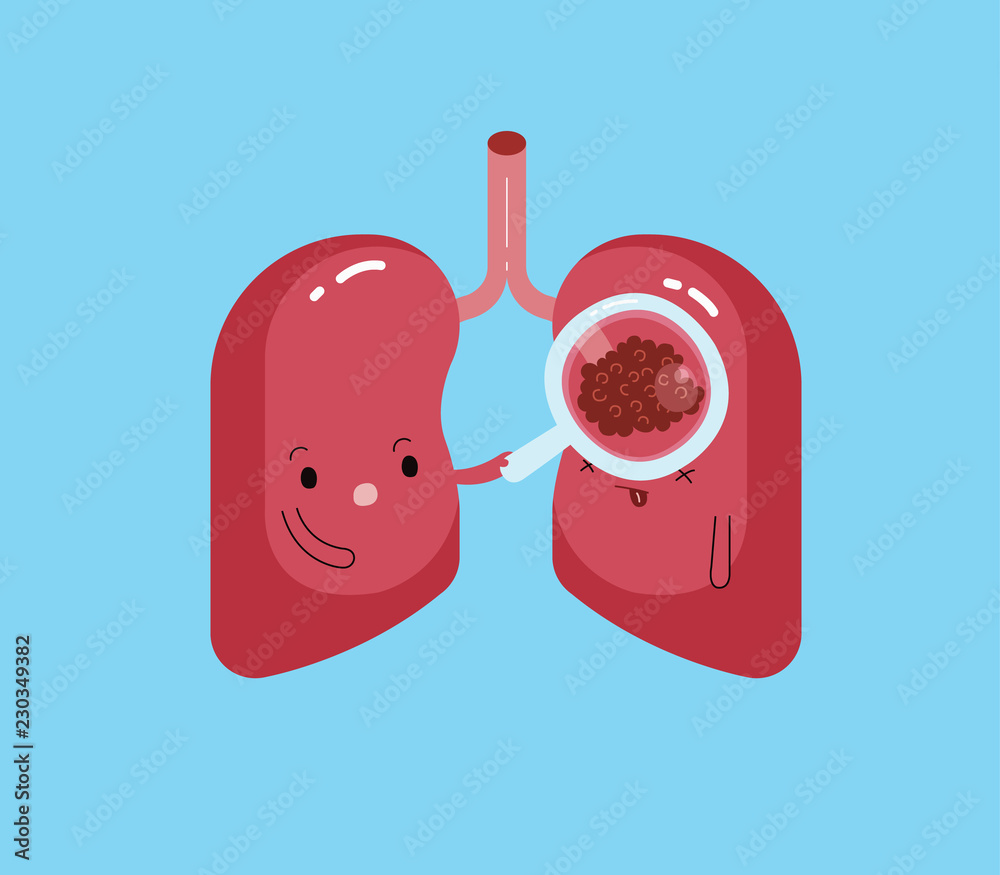 Lung find out lung cancer, disease of lung, cartoon vector of organ. Stock  Vector | Adobe Stock