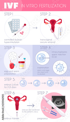 In Vitro Fertilization Infographics