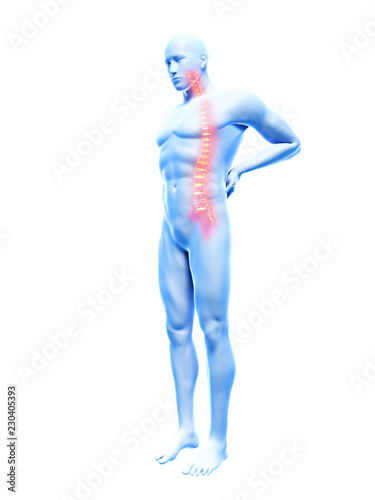 3d rendered illustration of a man having backache