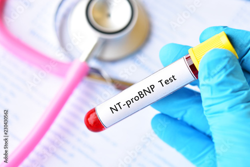Wall Mural Blood sample for N-terminal pro B-type natriuretic peptide or NT-proBNP test, ca