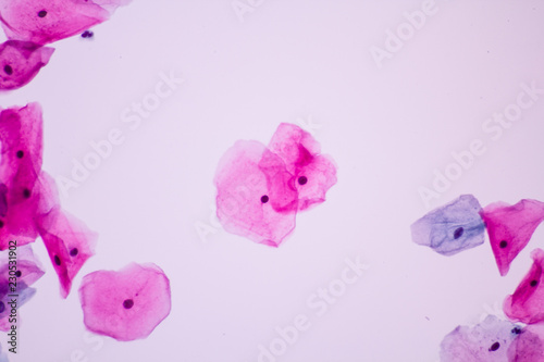 Fototapeta Naklejka Na Ścianę i Meble -  Normal squamous epithelial cells of cervical woman on white background view in microscopy.Superficial and intermediate epithelium cells.Cytology criteria from pap smear.Medical background concept.
