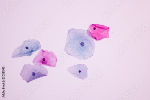 Normal squamous epithelial cells of cervical woman on white background view in microscopy.Superficial and intermediate epithelium cells.Cytology criteria from pap smear.Medical background concept. photo