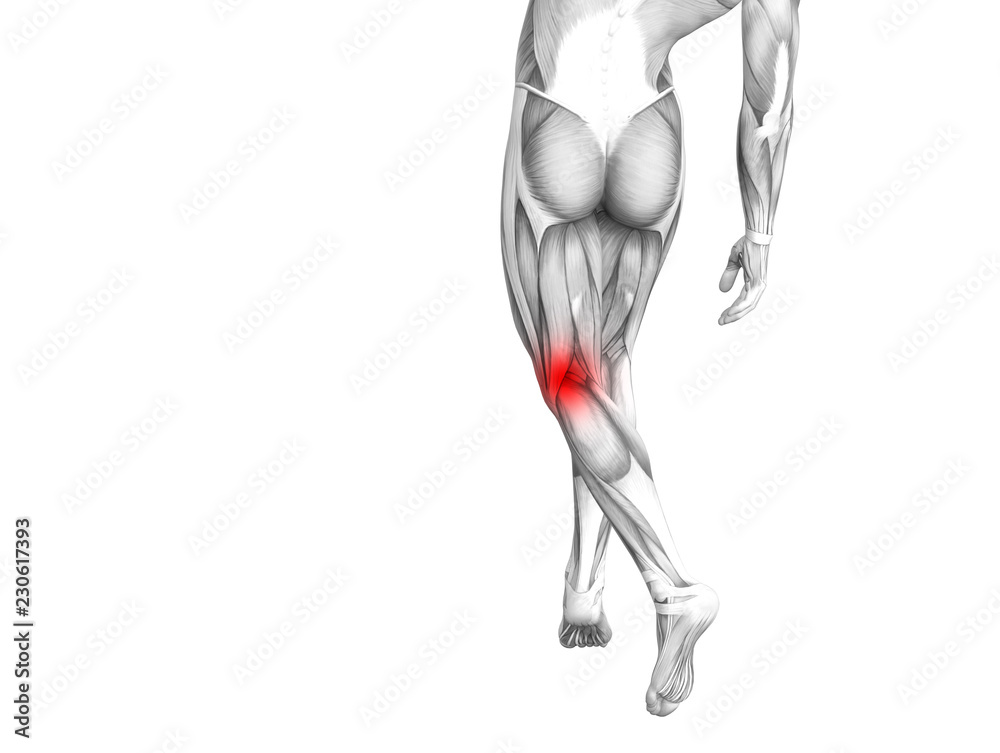 Conceptual knee human anatomy with red hot spot inflammation or articular joint pain for leg health care therapy or sport muscle concepts. 3D illustration man arthritis or bone osteoporosis disease Conceptual knee human anatomy with red hot spot inflammation or articular joint pain for leg health care therapy or sport muscle concepts. 3D illustration man arthritis or bone osteoporosis disease