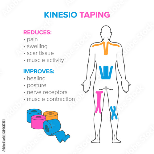 Kinesio taping. Reduses and improves