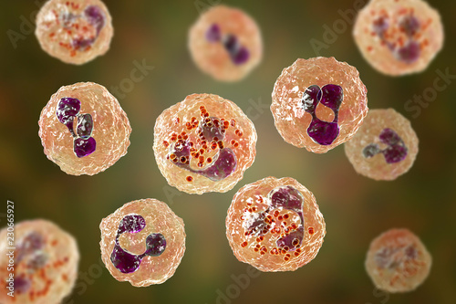 Meningococcal meningitis, cerebrospinal fluid smear photo