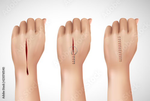 Surgical Stitching Hands Composition