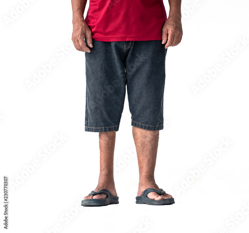 Picture shows a man with legs atrophy or legs are not equal but can stand and walk on his own. With regular exercise, clipping path