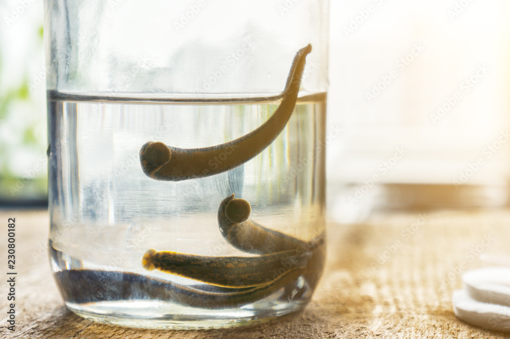 Medical leeches therapy. Hirudo medicinalis in a container with water.  Stock Photo